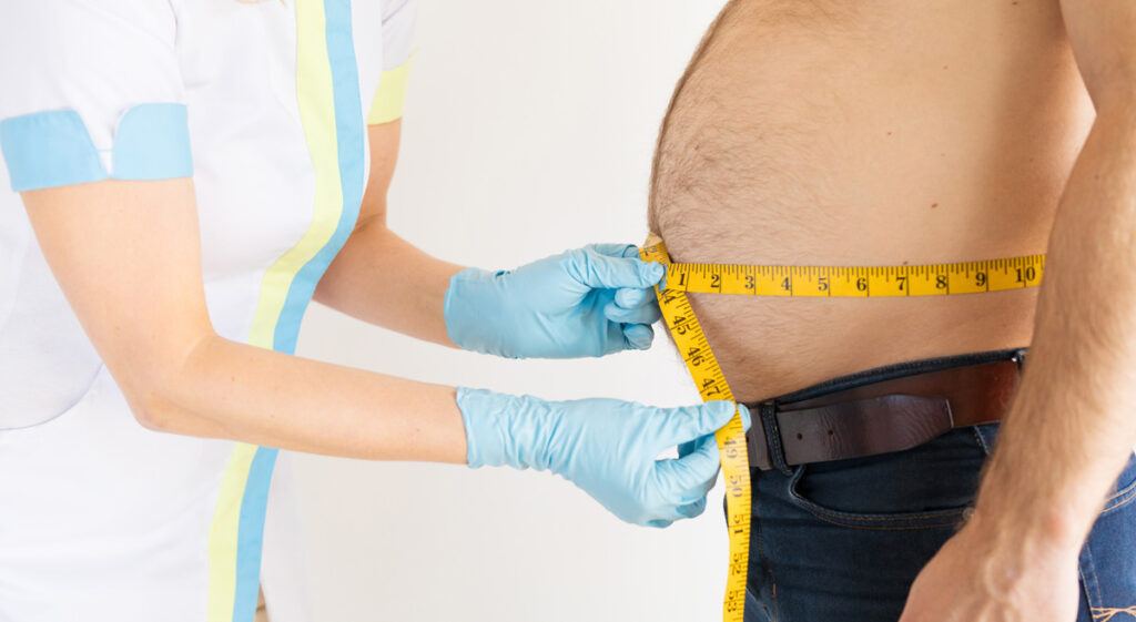 Der Bauch eines Mannes, der von einer Krankenpflegerin mit einem Maßband vermessen wird. (c) AdobeStock